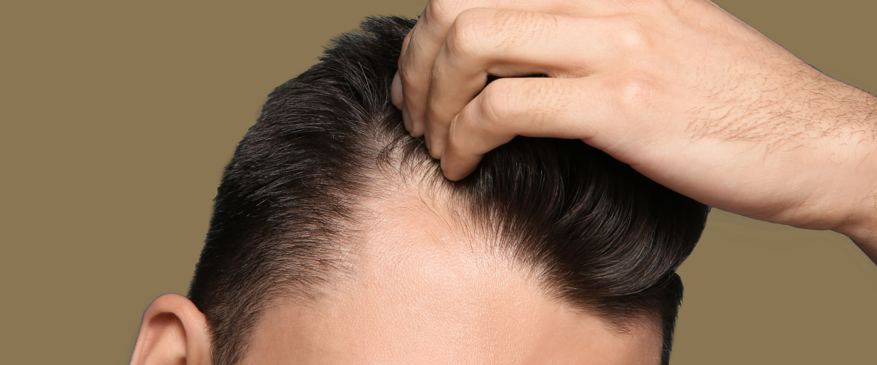 Male head with dark hair and a slight receding hairline.