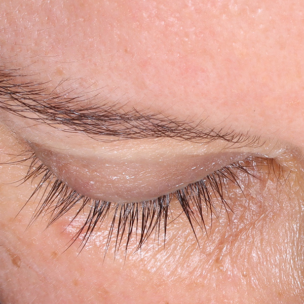 After Image