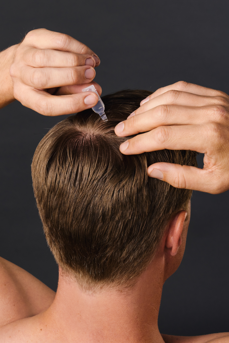 Man applying 8T3 hair serum precisely to the parting on the scalp – supports new hair growth